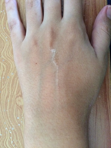 ceramide 9
