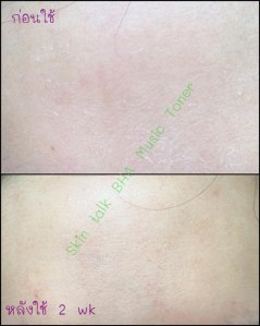 ก่อนใช้ vs หลังใช้-edit