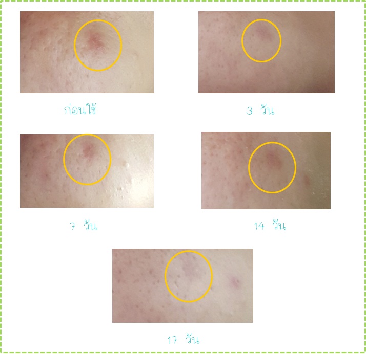 ผลการทดสอบ