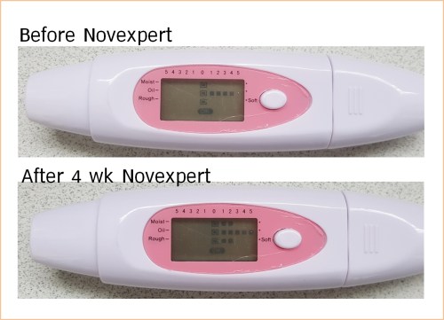 ผลวัดผิว