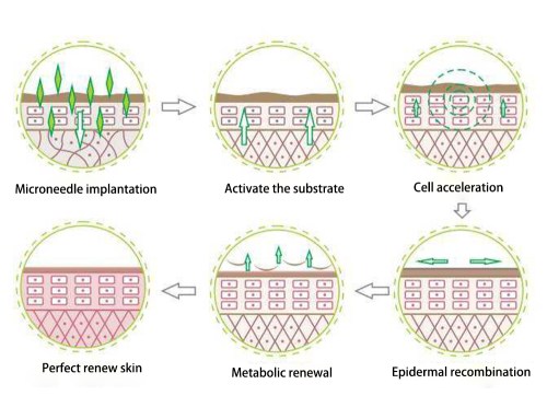 20181221150454225422